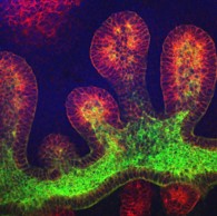 成長因子を用いると腎臓をつくる尿管芽が複数誘導される