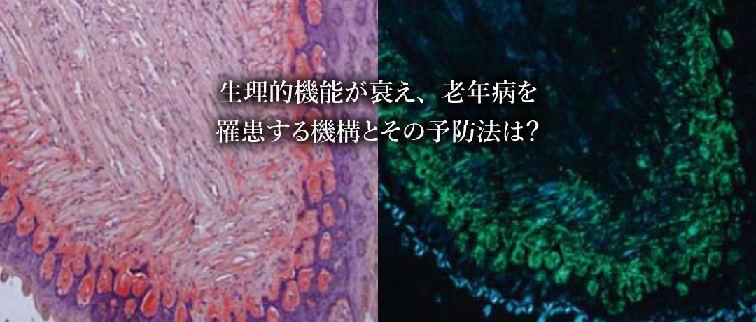 生理的機能が衰え、老年病を罹患する機構とその予防法は？