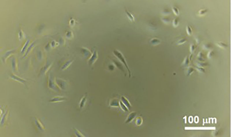 Morphologies of cells on the silk fibroin-based material.