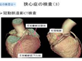 【狭心症】信大病院TV待合室～VOL.9　狭心症の予防と最新の治療