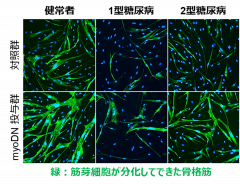 図：myoDNによる糖尿病筋芽細胞の分化の改善