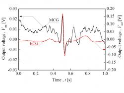 心臓電位波形（ECG)と心臓磁界波形（MCG）の計測結果