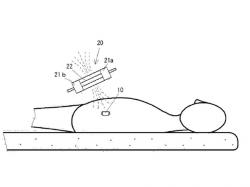 磁気を用いた大腸用カプセル内視鏡長時間停滞解消の概念図