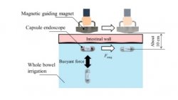 磁気誘導消化管検査概念図の一例（森川M2）