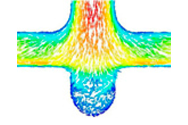 同動脈瘤にかかるWall Shear Stress