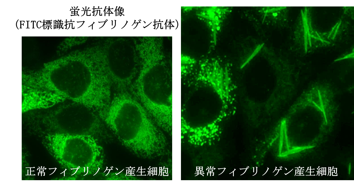 地域包括ケアシステム