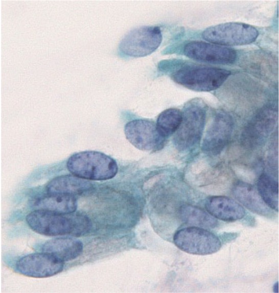 分葉状内頸部腺過形成の細胞像.JPG