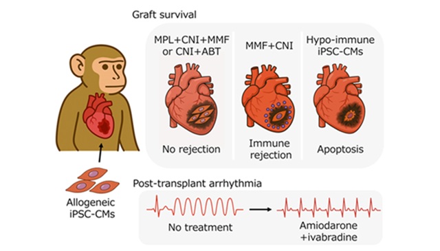 iPS細胞由来心筋細胞移植における免疫制御法を確立