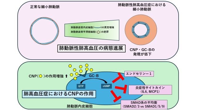 肺高血圧症の新規発症・進展メカニズムの解明</br>―新規治療法の開発につながる可能性―