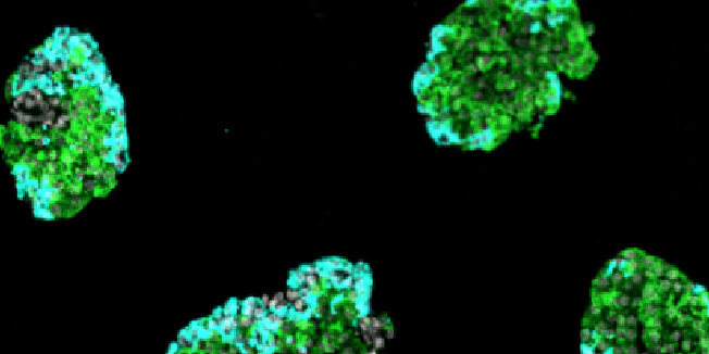 ガラス化保存膵島移植による1型糖尿病治療