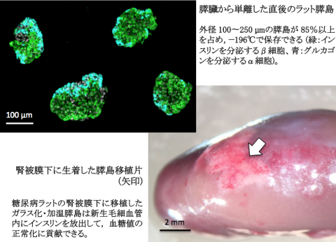 膵ランゲルハンス島を移植して糖尿病を治す