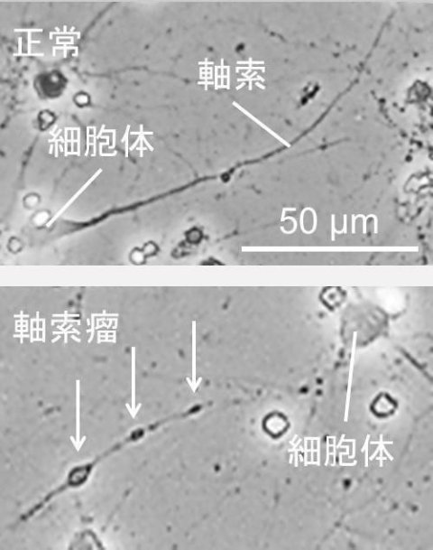 脳震盪の発生メカニズムを探る