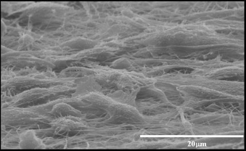 天然素材から作る体に優しい材料。高分子材料は体の修復の手助けもできる！？