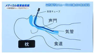 気管挿管_1.jpg