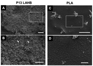 図2.-LAHB表面に無数の微生物が集まって分解している様子.jpg